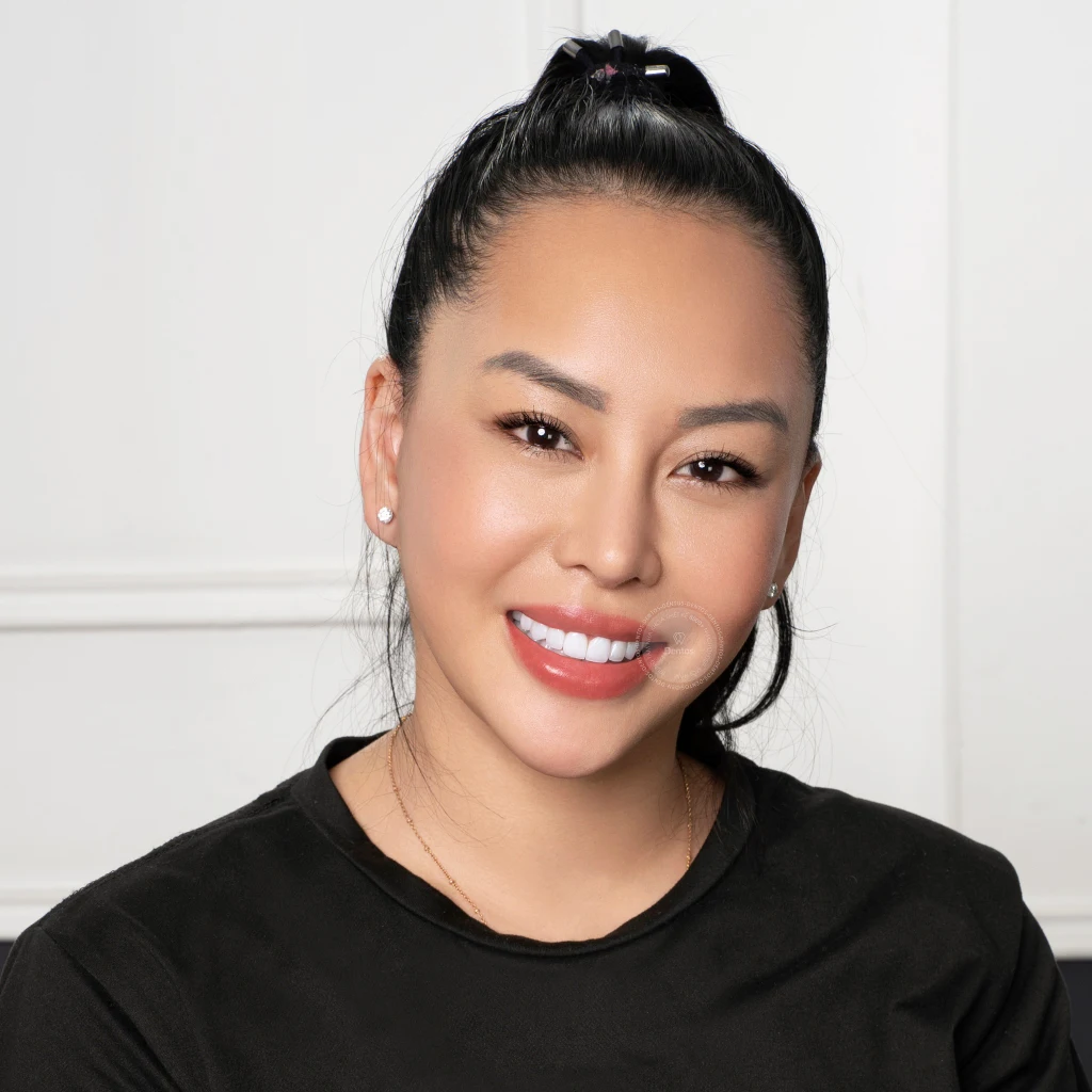 Mặt dán sứ Veneer tại Dentos hoàn toàn tự nhiên, không dày cộm hay gây hô